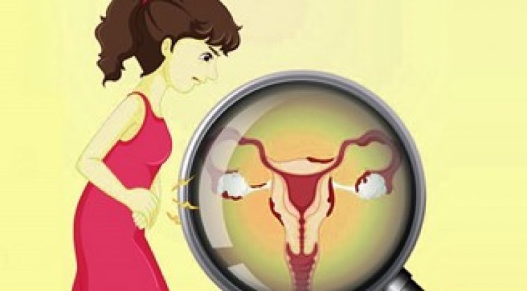 Cervical Cancer – Symptoms